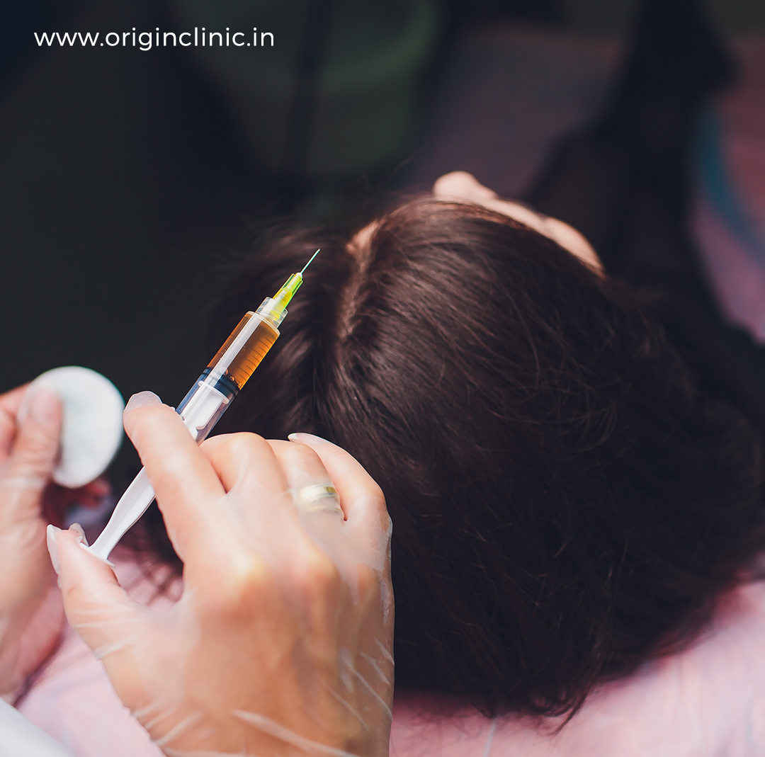 Hair transplantation Causes of Hair Fall Permanent Solution  Adorable  Clinic